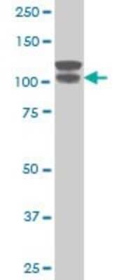 Western Blot: Rabbit anti-Llama VHH Secondary Antibody [DyLight 550] [NBP2-95273R] - Test125